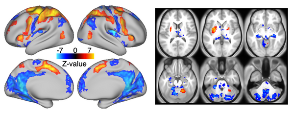 Tutorial: Finding and Assigning Peaks in Task-Related fMRI Analysis using Qunex