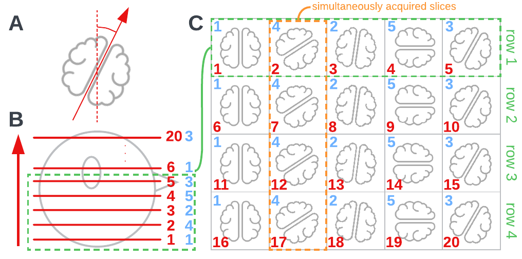 Empirically determining slice acquisition order of Philips Achieva MultiBand BOLD sequences